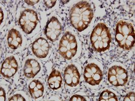 AKR1B10 antibody (ab57547) used in immunohistochemistry at 3ug/ml on formalin fixed and paraffin embedded human colon.