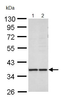 All lanes : Anti-AKR1B10 antibody (ab96417) at 1/1000 dilutionLane 1 : MOLT4 whole cell lysateLane 2 : Raji whole cell lysateLysates/proteins at 30 µg per lane.