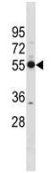 Anti-26S Proteasome regulatory subunit p55 antibody (ab156604) at 1/100 dilution + WiDr cell line lysates at 35 µg