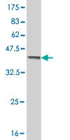 Western blot against tagged recombinant protein immunogen using ab54807 AKR1C2 antibody at 1ug/ml.