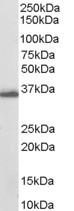 Anti-AKR1C3 antibody (ab27491) at 0.03 µg/ml + Human breast lysate (35µg protein in RIPA buffer). developed using the ECL technique