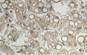 ab113503 at 1/100 dilution staining AKR1D1 in Human fetal liver by Immunohistochemistry Formalin-fixed, Paraffin-embedded tissue. Note cytoplasmic staining.