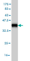 Western blot against tagged recombinant protein immunogen using ab57993 AKR1D1 antibody at 1ug/ml.