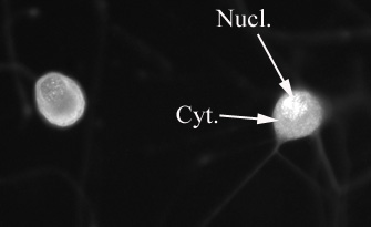 ab6076 detecting strong nuclear staining of AKT1/2 in adult dorsal root ganglion cells cultured for 2 days. ab6076 was used at 1/300 (incubated for 2h at room temperature). Secondary antibody used is anti-rabbit alexa fluor 488 (at 1/1000 for 1hr at room temperature). The cell diameter is approx. 25µm. Nucl = Nucleus; Cyt.=Cytoplasm.