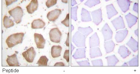 ab59341, at a 1/50 dilution, staining human 5 Lipoxygenase in skeletal muscle in the presence and absence of the immunizing peptide, using Immunohistochemistry, Paraffin embedded tissue.