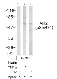 All lanes : Anti-AKT2 (phospho S474) antibody (ab38513) at 1/500 dilutionLane 1 : Extract of A2780 cells.Lane 2 : Extract of A2780 cells + TNF alpha.Lane 3 : Extract of A2780 cells + UV.Lysates/proteins at 30 µg per lane.SecondaryAlkaline Phosphatase AffiniPure Goat Anti-Rabbit IgG (H+L)