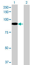 All lanes : Anti-ALDH16A1 antibody (ab70686)Lane 1 : Transfected 293T cell lineLane 2 : Non-transfected lysate