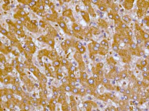 Immunohistochemical analysis of paraffin-embedded Human liver tissue labelling ALDH16A1 with ab137073 at 1/100 dilution.