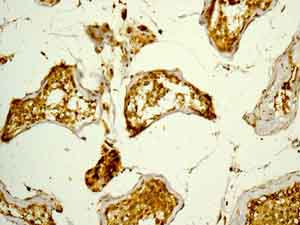 Immunohistochemical analysis of paraffin-embedded Human testis tissue labelling ALDH16A1 with ab137073 at 1/100 dilution.