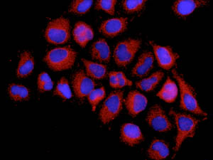 Immunofluorescent analysis of HeLa cells labelling ALDH16A1 with ab137073 at 1/250 dilution.