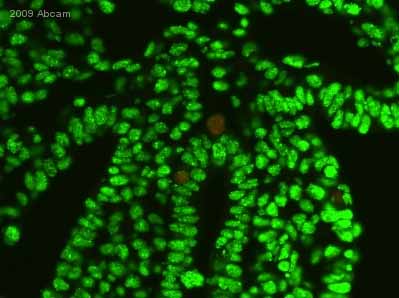 ab10805 staining 5-Methyl Cytidine in pig embryo (15 to 17 days) tissue section by Immunohistochemistry (Formalin/PFA-fixed paraffin-embedded sections). Tissue underwent fixation in paraformaldehyde, heat mediated antigen retrieval in Tris-EDTA buffer, permeabilization in Triton X-100 and blocking in 2% BSA for 10 minutes at 25°C. The primary antibody was diluted, 1/100 (PBS + 2% BSA) and incubated with sample for 1 hour at 25°C. An Alexa Fluor® 488 conjugated donkey polyclonal to mouse at 1/250 dilution, was used as secondary.See Abreview