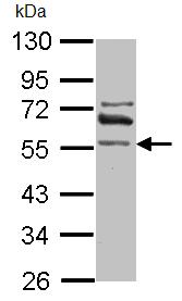 Anti-ALDH1A2 antibody (ab96060) at 1/1000 dilution + IMR32 whole cell lysate at 30 µg