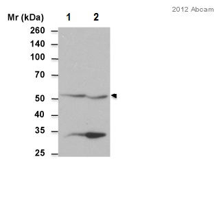 All lanes : Anti-ALDH1A2 antibody (ab96060) at 1/1000 dilutionLane 1 : Mouse Liver extractLane 2 : Mouse Kidney extractLysates/proteins at 100 µg per lane.SecondaryHRP conjugated Goat anti-rabbit at 1/4000 dilution