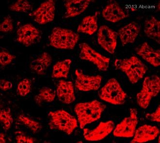 ab96060 staining ALDH1A2 in Mouse colon tissue sections by Immunohistochemistry (IHC-Fr - frozen sections). Tissue was fixed with formaldehyde and blocked with 5% serum for 20 minutes at 25°C. Samples were incubated with primary antibody (1/200 in PBS + 1% BSA) for 16 hours at 4°C. An AlexaFluor®594-conjugated Goat anti-rabbit IgG polyclonal (1/200) was used as the secondary antibody.See Abreview