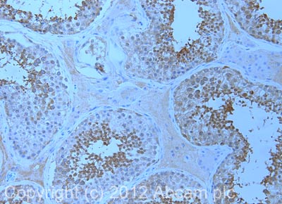 IHC image of ab75674 staining in human testis formalin fixed paraffin embedded tissue section, performed on a Leica BondTM system using the standard protocol F. The section was pre-treated using heat mediated antigen retrieval with sodium citrate buffer (pH6, epitope retrieval solution 1) for 20 mins. The section was then incubated with ab75674, 1µg/ml, for 15 mins at room temperature and detected using an HRP conjugated compact polymer system. DAB was used as the chromogen. The section was then counterstained with haematoxylin and mounted with DPX. For other IHC staining systems (automated and non-automated) customers should optimize variable parameters such as antigen retrieval conditions, primary antibody concentration and antibody incubation times.