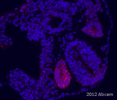 ab75674 staining ALDH1A2 on E9.5 mouse embryo sections by immunohistochemistry. The tissue was paraformaldehyde fixed and permeabilized in PBST prior to blocking in NOVOCASTRA protein block for 30 minutes at 25°C. The primary antibody was diluted 1/500 and incubated with the sample for 48 hour at 4°C. An Alexa Fluor 555 conjugated donkey anti-rabbit antibody, diluted 1/1000, was used as the secondary. Nuclear staining shown with DAPI.See Abreview