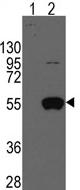 All lanes : Anti-ALDH2 antibody (ab70917) at 1/50 dilutionLane 1 : Nontransfected 293 cell line lysatesLane 2 : 293 cell line lysates transiently transfected with the ALDH2 geneLysates/proteins at 2 µg per lane.