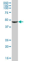 Anti-5-oxo-ETE GPCR antibody (ab88701) at 1 µg/ml + human liver tissue lysate at 50 µg