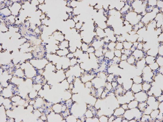 Immunohistochemical analysis of paraffin-embedded mouse lung tissue labeling ALDH4A1 using ab196612 at a 1/200 dilution.