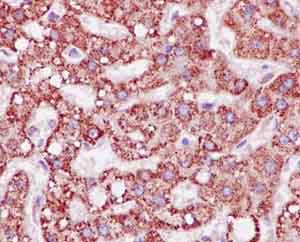 Immunohistochemical analysis of paraffin-embedded Human liver tissue labeling ALDH4A1 with ab185208 at 1/250 dilution. Counter stain Hematoxylin.