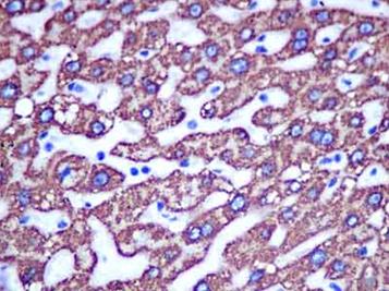 Immunohistochemical analysis of paraffin-embedded, Human liver tissue labeling ALDH4A1 with ab181256 at a 1/250 dilution. Counter stained hematoxylin.