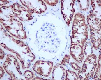 Immunohistochemical analysis of paraffin-embedded, Human kidney tissue labeling ALDH4A1 with ab181256 at a 1/250 dilution. Counter stained hematoxylin.