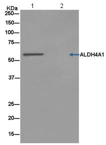 Western blot analysis on Immunoprecipitation from HepG2 cell lysate; showing ALDH4A1, using ab181256 at 1/50 dilution and HRP-conjugated anti-rabbit IgG preferentially detecting the non-reduced form of rabbit IgG at a 1/1500 dilution.