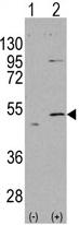 All lanes : Anti-ALDH5A1 antibody (ab65469) at 1/50 dilutionLane 1 : 293 cell lysates Lane 2 : 293 cell lysates, transfected with the ALDH5A1 gene Lysates/proteins at 2 µg per lane.
