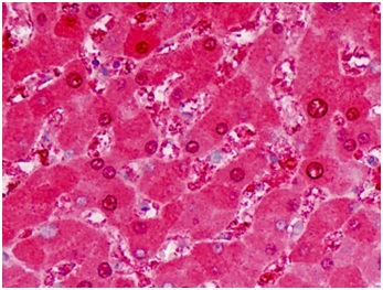Immunohistochemical analysis of paraffin embedded formalin fixed human liver tissue labeling ALDH5A1 using ab190071 at 10 µg/ml.