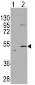 All lanes : Anti-ALDH5A1 antibody - N-terminal (ab190071) at 1/1000 dilutionLane 1 : 293T cell lysate non transfectedLane 2 : 293T cell lysate transfected with ALDH5A1Lysates/proteins at 2 µg per lane.