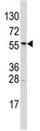 Anti-ALDH6A1 antibody (ab63181) at 1/50 dilution + T47D cell lysate at 35 µg