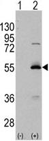 All lanes : Anti-ALDH6A1 antibody (ab65471) at 1/50 dilutionLane 1 : 293 cell lysate, nontransfectedLane 2 : 293 cell lysate, transiently transfected with the ALDH6A1 gene Lysates/proteins at 2 µg per lane.