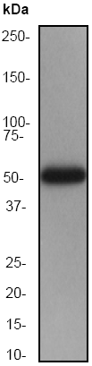 Anti-ALDH7A1 antibody (ab51029) at 1/10000 dilution + Fetal liver lysate at 10 µgSecondaryGoat anti-rabbit HRP labeled at 1/2000 dilution