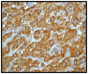 Ab51029 (1:100) staining human ALDH7A1 in human liver by immunohistochemistry using paraffin embedded tissue.