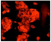 Imunofluorescent staining of HEPG2 cells using ab51029 (1:250).