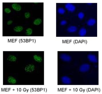 Ab36823, at a dilution of 1/100, staining 53BP1 foci in proliferating MEFs, both normal and exposed to 10 Gy of IR and double color immunofluorescence. Staining was for 2 hours. 
