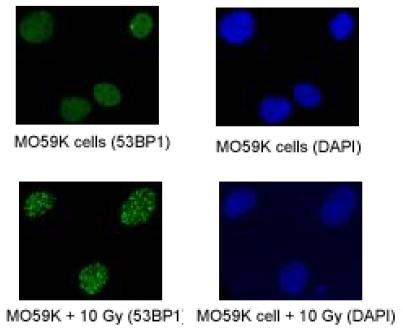 Ab36823, at a dilution of 1/100, staining 53BP1 foci in proliferating MO59K cells, both normal and exposed to 10 Gy of IR and double color immunofluorescence. Staining was for 2 hours. 