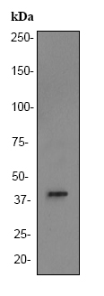 Anti-ALDOB antibody [EPR3138Y] (ab75751) at 1/1000 dilution + fetal kidney lysate at 10 µgSecondaryHRP labelled goat anti-rabbit at 1/2000 dilution
