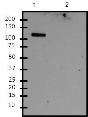 All lanes : Anti-ALG1 antibody (ab155935) at 1/5000 dilutionLane 1 : Wild type Caenorhabditis elegans extract Lane 2 : ALG1 negative (-) Caenorhabditis elegans extract Lysates/proteins at 15 µg per lane.SecondaryGoat anti-rabbit HRP conjugated antibody at 1/15000 dilution