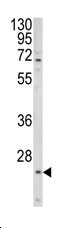 Anti-ALG14 antibody (ab176239) at 1/1000 dilution + NCI-H460 cell line lysate at 35 µg