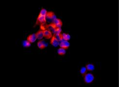 Immunofluorescence analysis of 293 cells (fixative 4% paraformaldehyde) labeling ALG2 with ab181124 at a 1/250 dilution.Goat anti rabbit IgG (Alexafluor 555) secondary used at a 1/200 diution.