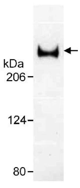 Anti-53BP1 antibody (ab36828) at 1/2000 dilution + Whole cell lysate from human U205 cells at 20 µgdeveloped using the ECL technique
