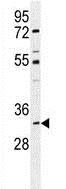 Anti-ALKBH6 antibody (ab170186) at 1/100 dilution + Mouse cerebellum tissue lysate at 35 µg