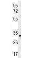 Anti-ALKBH6 antibody (ab170186) at 1/100 dilution + MDA-MB435 cell line lysate at 35 µg