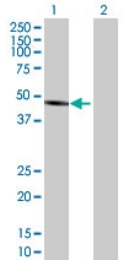 All lanes : Anti-ALLC antibody (ab69067) at 1/500 dilutionLane 1 : ALLC transfected 293T cell lysateLane 2 : Non transfected 293T cell lysateLysates/proteins at 25 µg per lane.SecondaryGoat anti-mouse IgG (H&L)-HRP conjugate at 1/2500 dilution
