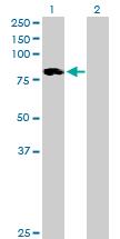 All lanes : Anti-ALOXE3 antibody (ab73091) at 1/500 dilutionLane 1 : ALOXE3 transfected 293T cell lysateLane 2 : Non transfected 293T cell lysateLysates/proteins at 25 µg per lane.SecondaryGoat Anti-Mouse IgG (H&L)-HRP conjugated at 1/2500 dilution