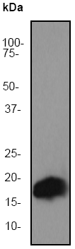 Anti-alpha + beta Synuclein antibody [EP1646Y] (ab51252) at 1/50000 dilution + Fetal brain lysate at 10 µgSecondaryGoat anti-Rabbit HRP labeled. at 1/2000 dilution