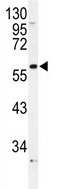 Anti-alpha 1 Adrenergic Receptor antibody (ab86772) at 1/100 dilution + NCI-H460 cell lysate at 35 µg