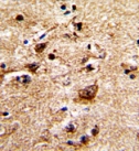 Formalin fixed and paraffin embedded Human brain tissue labelled with ab86772 (1/50 dilution), which was peroxidase conjugated to the secondary antibody, followed by DAB staining.