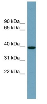 Anti- NUDCD3 antibody (ab104981) at 1 µg/ml + Human fetal thymus lysate at 10 µg